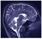 Исследование мозга человека с использованием магнитно-резонансного аппарата дает незаменимую информацию для медицины