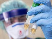 Среди персонала Чернобыльской АЭС зафиксированы 2 новых случая коронавирусной инфекции COVID-19