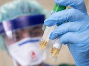 СУЭК применяет все виды тестирования на коронавирусную инфекцию и вакцинирует сотрудников